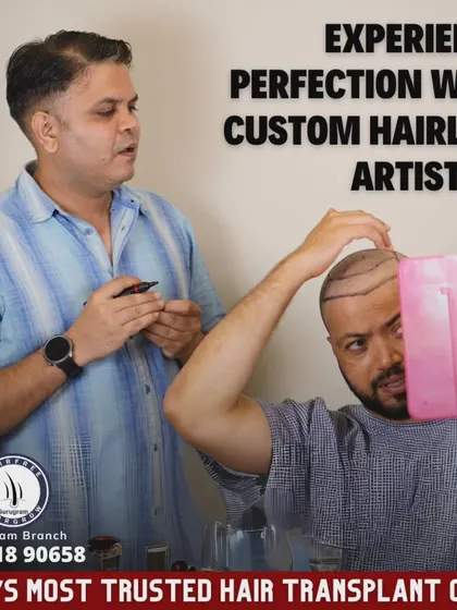 Designing the perfect hairline is both a science and an art. Here, you can see me personally working with a patient, marking out a custom hairline that will suit his facial structure and look completely natural. Your involvement in this step is crucial.