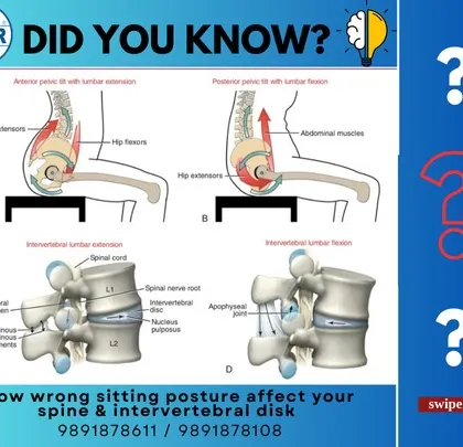 This scientific illustration explains exactly how wrong sitting posture affects your spine and intervertebral discs. Understanding the mechanics of disc pressure and misalignment helps motivate the need for better posture.