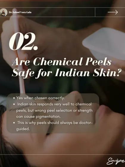 A common question I get is whether chemical peels are safe for Indian skin. The answer is yes, but only when the correct peel and strength are chosen by a doctor. The wrong choice can cause pigmentation, which is why professional guidance is essential.