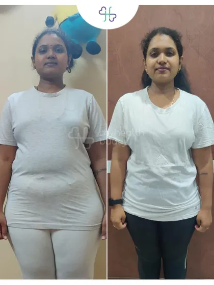 A front view of Ramya's transformation. She appreciated the supportive coaching and how we corrected her food intake and exercise at every phase.