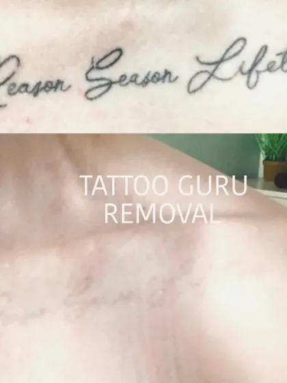This client wanted to remove a quote from their collarbone. The after photo shows the skin almost completely clear, with only very faint traces of the old ink remaining.