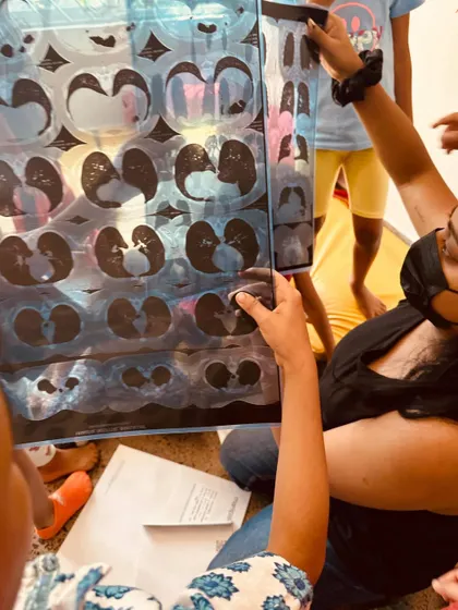 A Playmaker shows the children a real CT scan of lungs. We don't shy away from complex topics; instead, we find age-appropriate ways to introduce them, trusting in the children's capacity to understand.
