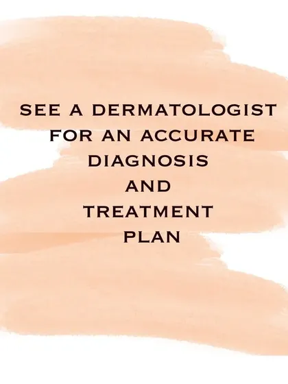 Rosacea is a common but often overlooked condition. If you experience persistent redness and flushing, see a dermatologist for an accurate diagnosis and a treatment plan tailored to your triggers.