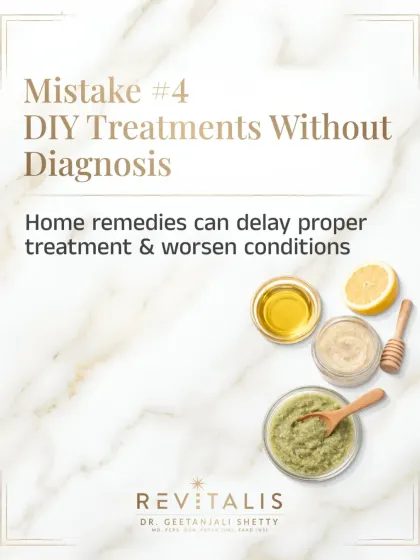 Mistake #4: DIY Treatments Without Diagnosis. This graphic highlights the danger of self-treating with home remedies, which can delay proper medical treatment and worsen skin or scalp conditions.