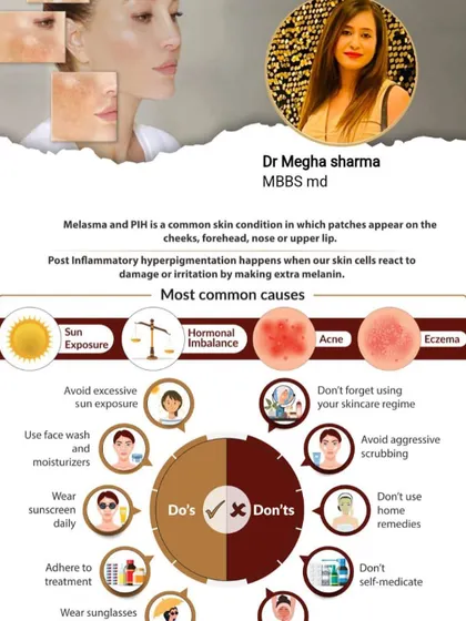 Melasma and Post-Inflammatory Hyperpigmentation (PIH) are common concerns. This infographic explains the causes and lists important do's and don'ts, such as wearing sunscreen daily and avoiding self-medication.