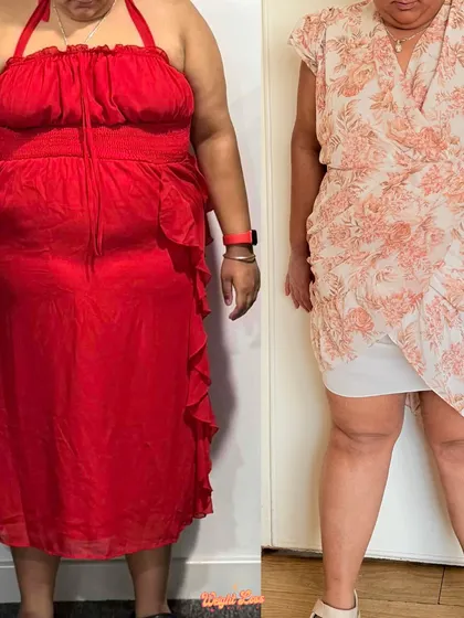 This is Anjali, who was diagnosed with Type 2 Diabetes. She committed to change and is already 8.6kg down. We built a routine around swimming and walks, and she's taking control of her health while still enjoying life.
