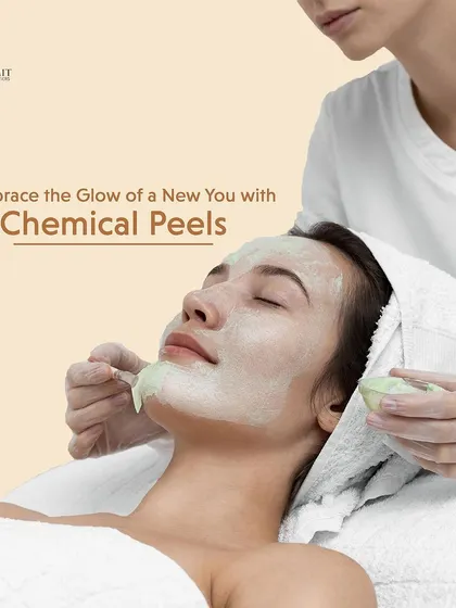 A chemical peel is a fantastic way to reset your skin. Here, a client is receiving a professionally applied peel, a procedure we use to gently exfoliate, reduce hyperpigmentation, and reveal a smoother, more radiant complexion underneath. It is a controlled and safe way to achieve a healthy glow.