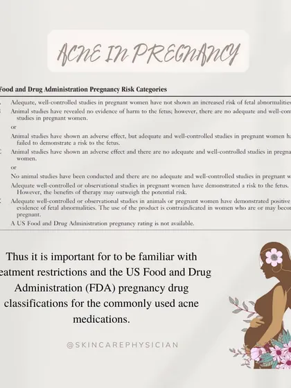 This is a duplicate of the FDA pregnancy risk categories table. It is a critical piece of information that I always review with my patients to ensure they are fully aware of the safety profiles of commonly used acne medications.