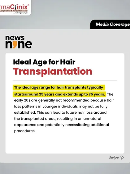 This graphic from a News9Live article specifies the ideal age range for a hair transplant, typically from 25 to 75 years, and explains why caution is advised for younger patients.