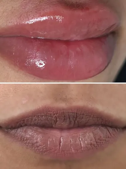 This is a clear example of neutralizing dark, cool-toned lips. The 'before' shows significant pigmentation, and the 'after' reveals a complete color shift to a warm, rosy pink. The lips appear healthier, plumper, and more vibrant.