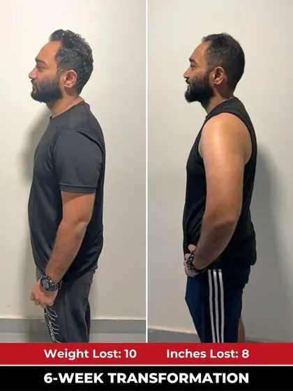 The side-profile comparison clearly shows the 10 kg weight loss, with a visibly flatter stomach and more defined upper body, highlighting the effectiveness of our transformation program.