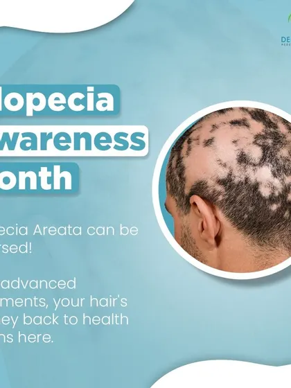 It's important to know that Alopecia Areata can often be reversed. With advanced treatments, we can help you on your journey back to hair health.