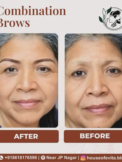 Permanent makeup is for everyone. For this client, I used Combination Brows to restore shape and definition that had been lost over time, creating a subtle lift and a more youthful appearance.