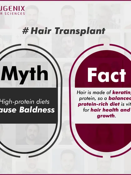 A series of graphics debunking common myths about fitness and hair loss, such as whether exercise, sweating, or high-protein diets cause baldness.