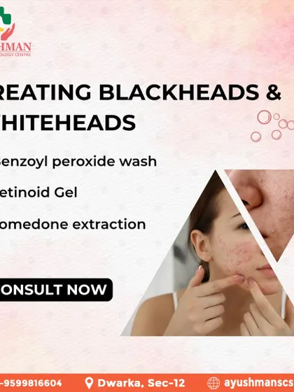 I treat blackheads and whiteheads using proven methods like Benzoyl peroxide washes, Retinoid gels, and professional comedone extractions for clear, unclogged pores.