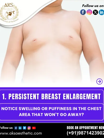 Notice swelling or puffiness in the chest area that won't go away? This is a common sign of gynecomastia, which is an enlargement of the male breast tissue.