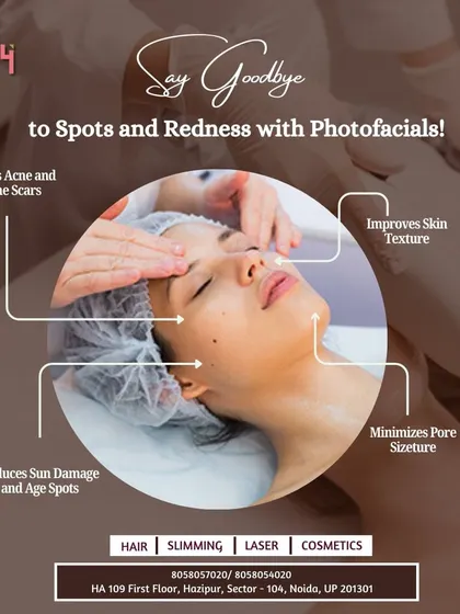 Say goodbye to spots and redness with Photofacials. This infographic shows how the treatment works to treat acne, reduce sun damage, improve skin texture, and minimize pore size all at once.