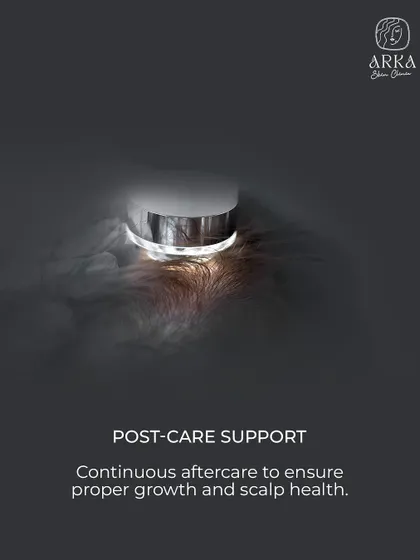 My commitment to you doesn't end after the procedure. I provide continuous post-care support to monitor your progress, ensure proper hair growth, and maintain long-term scalp health.
