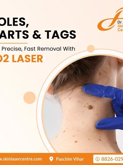 I use a CO2 laser for safe, precise, and fast removal of moles, warts, and skin tags. This image illustrates the type of examination I conduct to ensure the correct diagnosis and treatment.