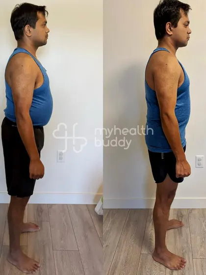 Side view showing a visible reduction in abdominal fat and improved overall posture. This is the result of dedication and a smart, sustainable plan.