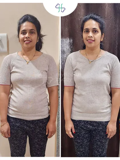 Front view of her 5 kg weight loss. She is continuing her journey to lose another 5 kgs with confidence.