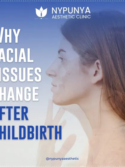 Many women wonder why their facial tissues change after childbirth. It's a common experience driven by hormonal shifts and changes in fat distribution.