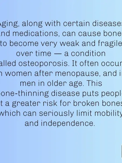 Osteoporosis, a condition of brittle bones, is a serious risk as we age. It can be mitigated with proper exercise and nutrition.