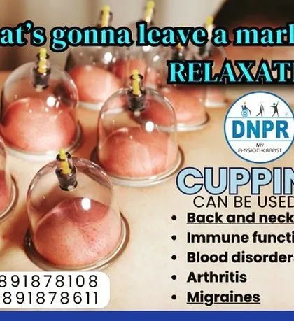 Those marks are a sign of relaxation and improved blood flow. Cupping therapy is a versatile treatment we use for back and neck pain, improving immune function, and even helping with conditions like arthritis and migraines.