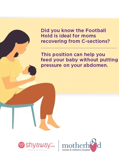 For mothers recovering from a C-section, the Football Hold can be an ideal breastfeeding position. It allows you to feed your baby comfortably without putting pressure on your abdominal incision, making the experience less stressful.
