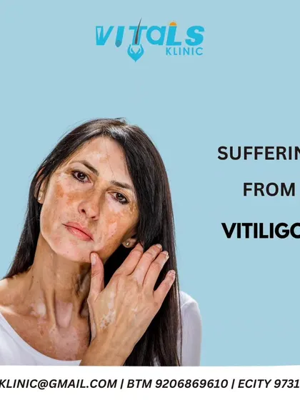 If you are suffering from vitiligo, we offer a combination of treatments designed to restore your natural skin color. We are committed to providing the best possible care to help you say goodbye to vitiligo.