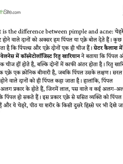 An excerpt from my article in The Health Site, where I clarify the difference between a pimple and acne. Acne is the disease, and a pimple is a symptom.