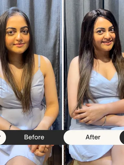 A side-by-side comparison showing the confidence-boosting power of our silk scalp topper. The 'after' photo reveals a fuller, more vibrant look that still appears completely natural.