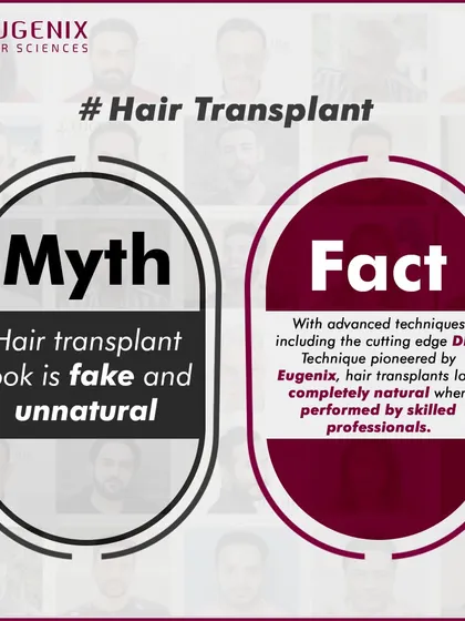 We tackle the biggest myths head-on: hair transplants are painful, only for celebrities, look fake, are dangerous, or are better done abroad.