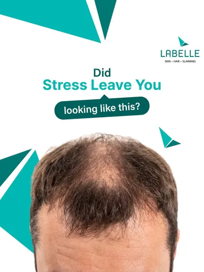 Did stress leave you with thinning hair? The good news is that stress-induced hair loss is often reversible if you act fast. Our regrowth treatments are designed to help you recover your hair and your confidence.