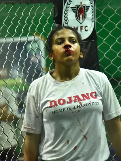 This is the reality of the fight game. Bleeding but unbroken, this fighter wanted to continue. My first priority is always my fighter's safety, even when their heart wants to keep going.