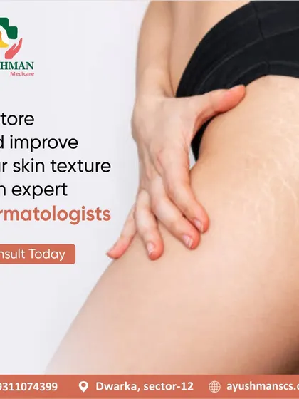 We can help restore and improve your skin texture, whether it's on your face or body. Our expert dermatologists are here to provide solutions for concerns like stretch marks and uneven skin.