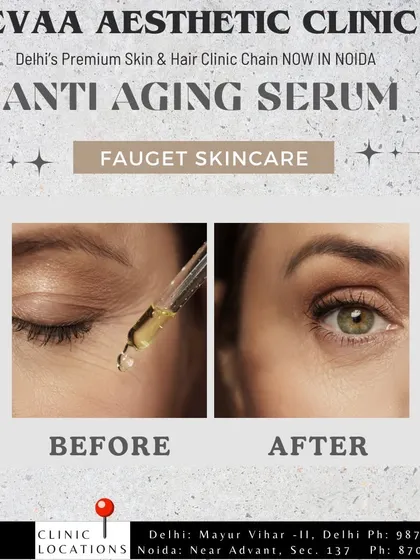 See the visible reduction in fine lines and improved skin texture around the eye area after using our recommended anti-aging serum as part of a comprehensive treatment plan.