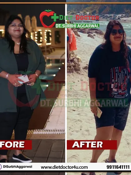 A client's before and after, showcasing a visible reduction in weight and a healthier appearance. This is the result of committing to a balanced diet and an improved lifestyle.