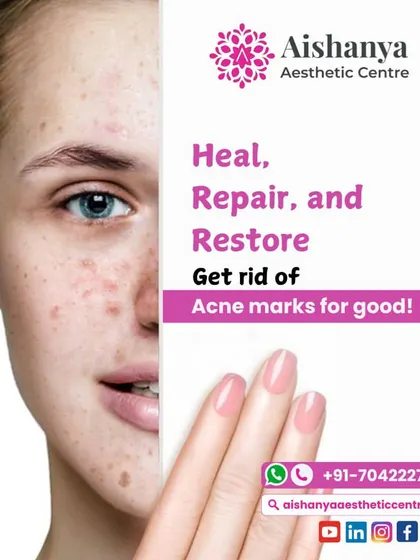 This graphic is a powerful reminder to heal, repair, and restore your skin. My treatments are designed not just to clear acne marks, but to improve the overall health and resilience of your skin.