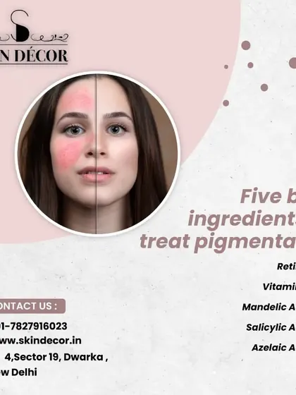 These are five of the best ingredients I recommend for treating pigmentation. Retinol, Vitamin C, Mandelic Acid, Salicylic Acid, and Azelaic Acid each work in different ways to reduce dark spots and even out skin tone. However, it is crucial to use them under a dermatologist's guidance.