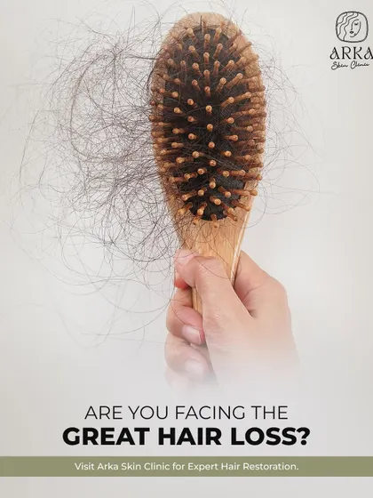 Seeing a brush full of hair can be alarming, but it's a common issue that I am equipped to handle. I offer expert hair restoration services that begin with a proper diagnosis to stop the great hair loss and start the regrowth journey.