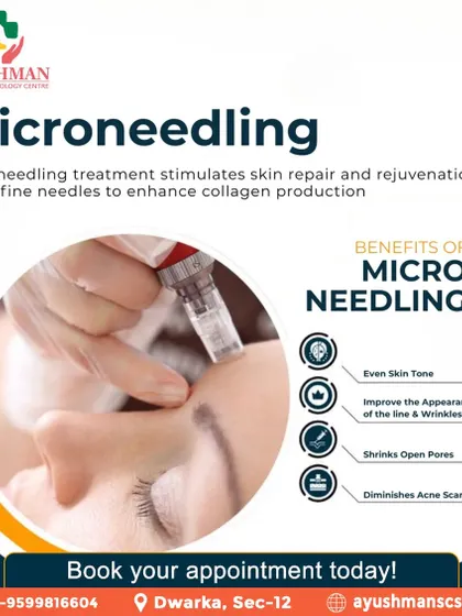 Microneedling is a powerful collagen-stimulating treatment. By creating micro-channels in the skin, it promotes natural repair and rejuvenation, helping to even skin tone, reduce wrinkles, shrink open pores, and diminish acne scars.
