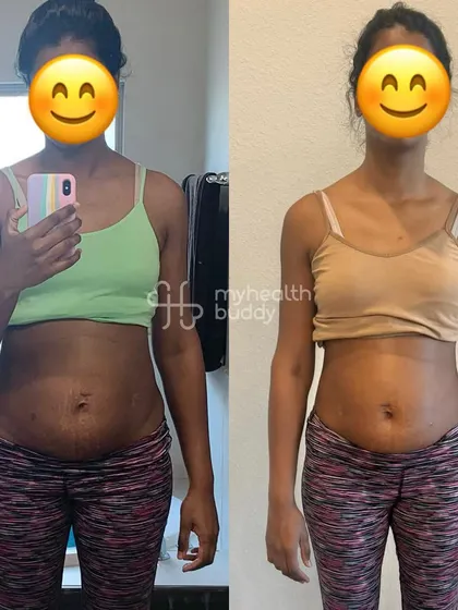 This client got rid of her postpartum weight and got fitter. She shed 5 kgs in the first month and continued to tone her body, which also helped with her PCOD.