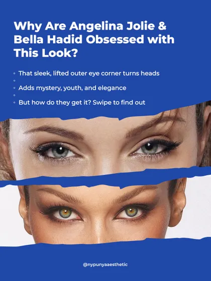 Why are celebrities like Angelina Jolie and Bella Hadid associated with this look? The sleek, lifted outer eye corner adds an element of youth and elegance.