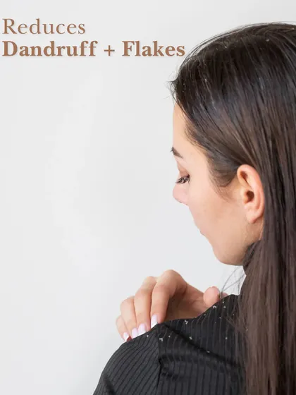 One of the key benefits of scalp exfoliation is that it reduces dandruff and flakes by clearing away dead skin cells and buildup.