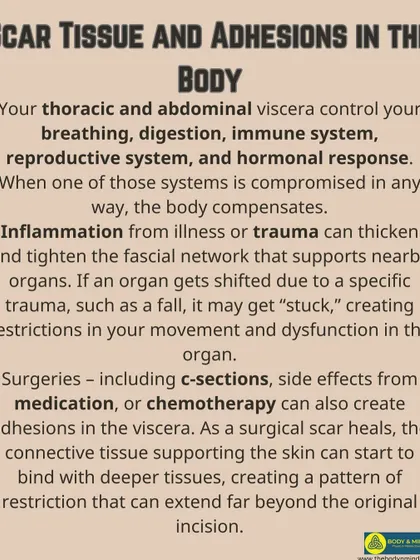 A duplicate of the scar tissue and adhesions infographic.