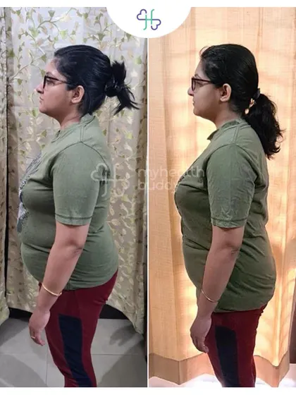 Another angle of Sneha's progress. She was so happy with her results that she referred six other people, including her husband.