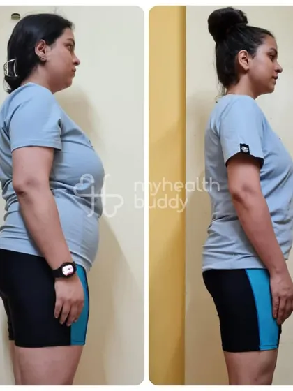 A side view of Shipra's progress. My goal was to not only transform her physique but also her mindset, helping her feel more energetic and optimistic.