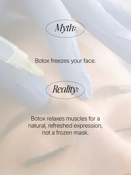 One of the most common myths is that Botox freezes your face. The reality is, when administered by an expert dermatologist, it selectively relaxes muscles to smooth wrinkles while preserving your natural expressions for a refreshed, not frozen, look.