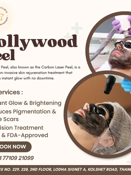 This graphic explains the Hollywood Peel, a non-invasive rejuvenation treatment that delivers an instant glow with no downtime. It's excellent for reducing pigmentation and improving skin texture.